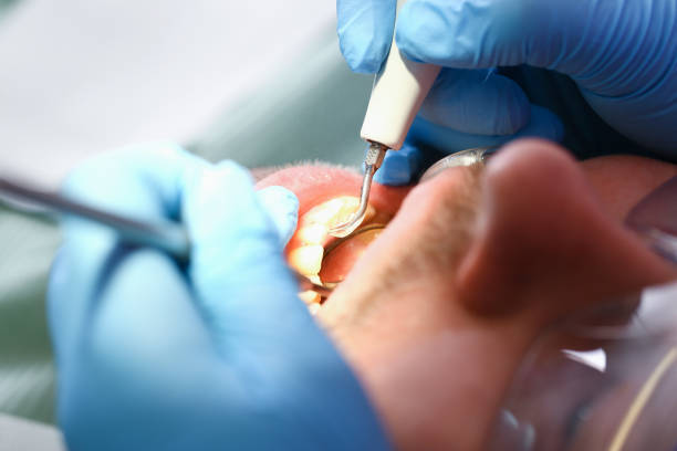 Best Emergency Dental Care for Broken or Chipped Teeth in Wurtland, KY