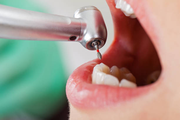 Best Emergency Denture Repair in Wurtland, KY